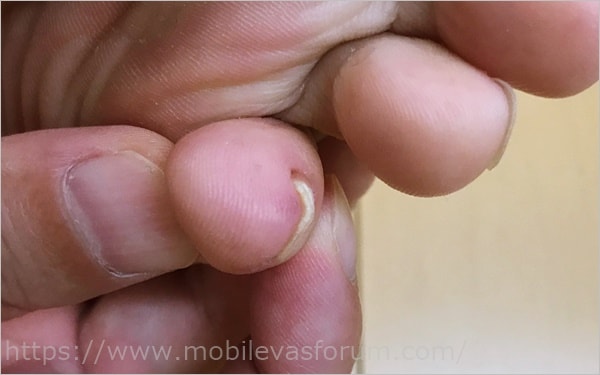 クリアネイルショットと厚い爪2